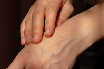 Birthmarks on skin Close up detail of the bare skin Sun Exposure effect on skin, Health Effects of...