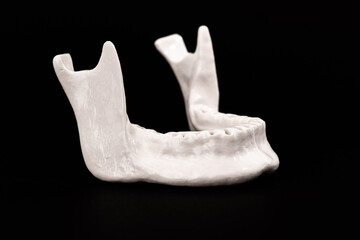 Upper human jaw without teeth model medical implant isolated on black background. Healthy teeth, dental care and orthodontic concept.