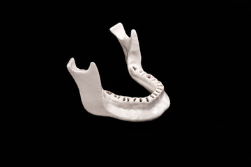 Upper human jaw without teeth model medical implant isolated on black background. Healthy teeth, dental care and orthodontic concept.