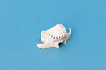 Upper human jaw without teeth model medical implant isolated on blue background. Healthy teeth, dental care and orthodontic concept.