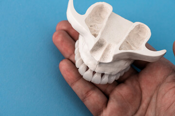 Upper human jaw with teeth anatomy model isolated on blue background. Healthy teeth, dental care and orthodontic medical concept. 