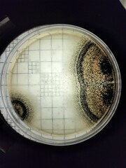 Taking pictures at the microbial colony counter