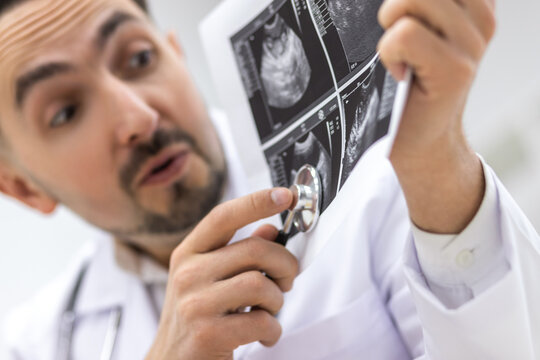 Cropped photo of a male doctor looking at ultrasound result.