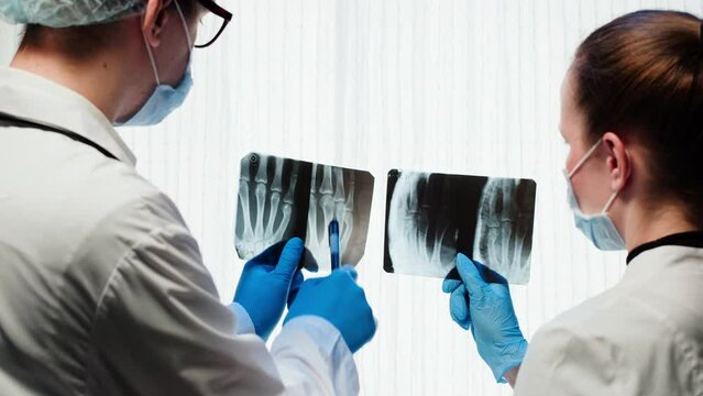 Doctors looking at hand fingers x-ray close-up. Magnetic Resonance Image of human arm. Man and woman nurse examining xray of palm bones. Healthcare and medicine concept.