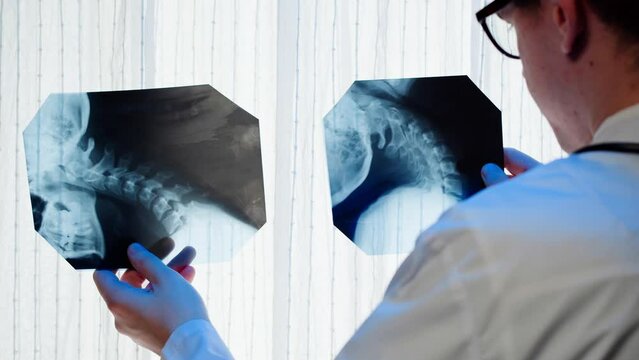 Doctor examining neck x-ray close-up. Magnetic Resonance Image of Spinal Column, Skull Head. Man therapist looking at xray of spine bones. Healthcare and medicine concept.