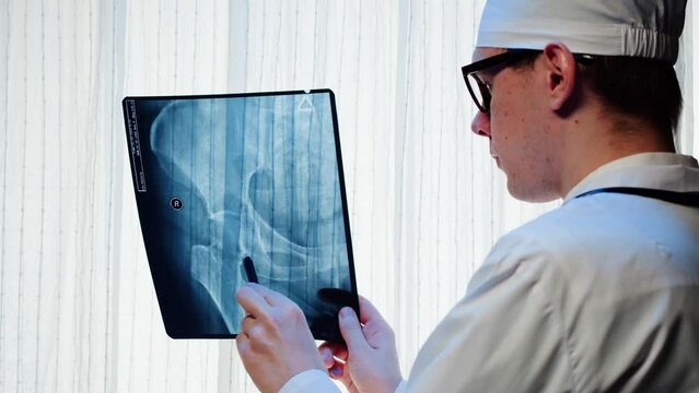 Doctor examining pelvis hip x-ray close-up. Magnetic Resonance Image of human leg. Man nurse looking at xray of foot bones. Healthcare and medicine concept.