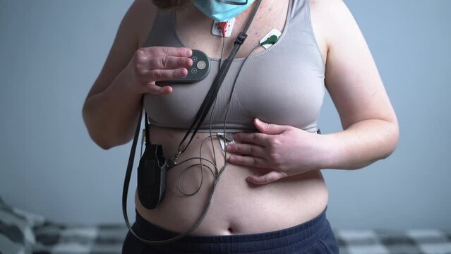 Woman with holter monitor device for daily monitoring of electrocardiogram. Female wearing holter monitor device for daily monitoring of an EKG against the gray wall. Treatment of heart diseases 