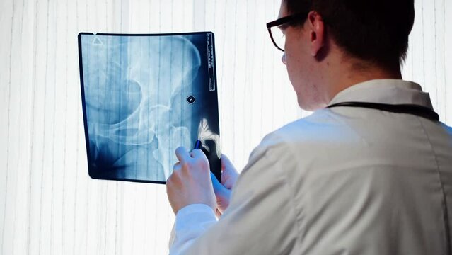 Doctor examining pelvis hip x-ray close-up. Magnetic Resonance Image of human leg. Man nurse looking at xray of foot bones. Healthcare and medicine concept.