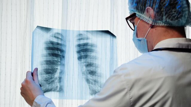 Healthcare and medicine. Doctor examining lungs x-ray close-up. Male nurse looking at ribs roentgen, human chest, checkup
