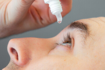 Ophthalmology. A man instills medicine into his eye. Close-up. The concept of irritation and...
