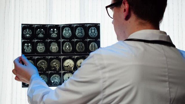 Doctor examining X-ray, Magnetic resonance image of head. Man nurse looking at human brain MRI close-up. Advanced research of body, checkup tomography. 