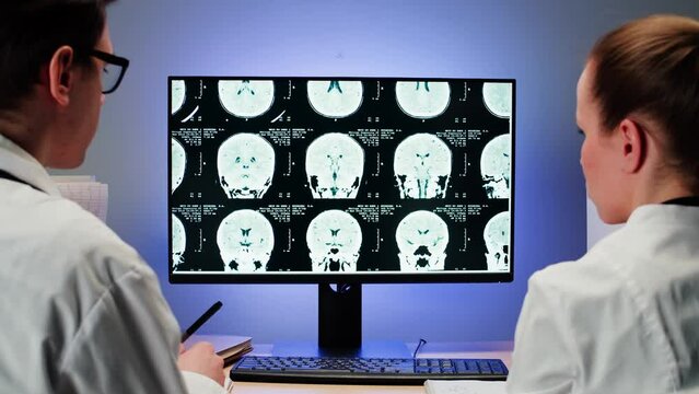 Doctors examining X-ray on computer monitor. Magnetic resonance image of head. Man and woman nurse looking at human brain MRI close-up. Advanced research of body, checkup tomography. 
