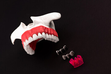 Teeth implant and crown installation process parts isolated on a blue background. Medically...