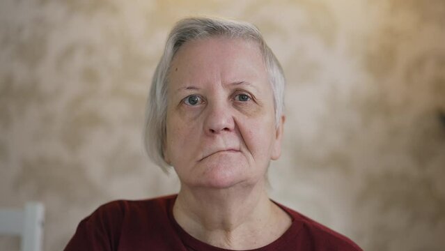 Portrait of a woman with facial paralysis