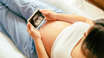 Ultrasound photo pregnancy baby. Woman holding ultrasound pregnant picture. Concept maternity,...