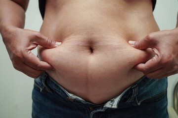 Overweight asian woman use hand to squeeze fat belly big size overweight and obesity.