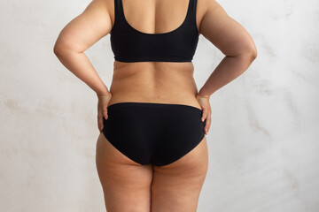 Cropped rearview of fat, adipose, overweight female body in black underwear, checking and holding excess folds, sides on back. Cellulite friable skin problem. Dieting and unhealthy eating problem