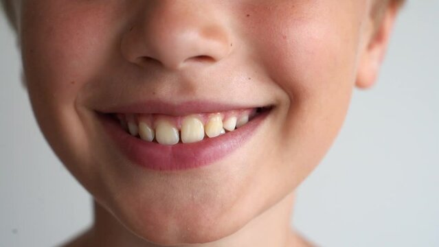Close up of caucasian child's nose and mouth. Smiling, lips and shows teeth. Gap between white teeth over white background