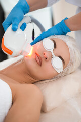 Skin Treatment Concepts. Laser RF-Rejuvenation Skin Procedure For Aesthetic Facial Treatment Or Skincare