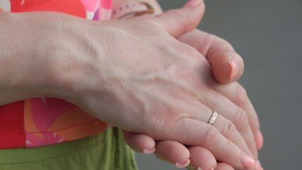 Bulging veins on women's arms.