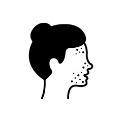 Girl with Pimples on Face Silhouette Icon. Woman with Blackhead, Acne, Rash Pictogram. Dermatologic Problem, Allergy, Inflammation Skin Black Icon. Isolated Vector Illustration