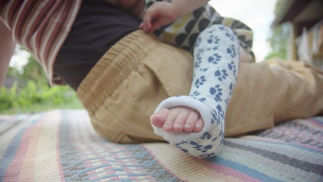 CLOSEUP, FOCUS on TOES of a young childs broken leg, sitting on mum