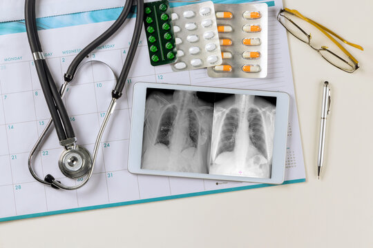 Doctor Checks Digital Monitor On X-ray The Correct Installation Of A Pacemaker In Medical Office