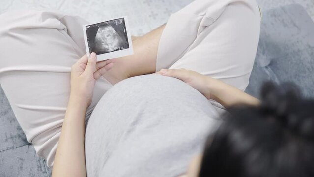 Pregnant Asian woman holding ultrasound figure caressing the belly with love and tenderness Waiting, there is still hope in the room. High top view.