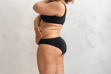 Cropped overweight fat woman pinching and checking volume of sides in black bikini. Excess skin...