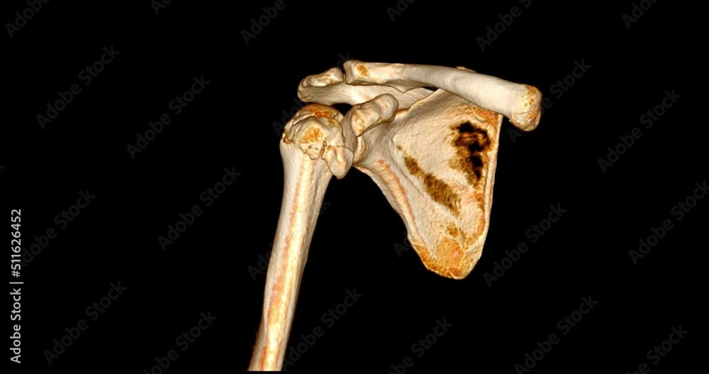Poster ct scan shoulder joint 3d rendering image.