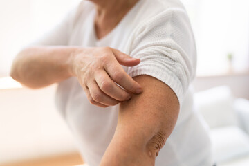 Woman Scratching Itching Body Skin
