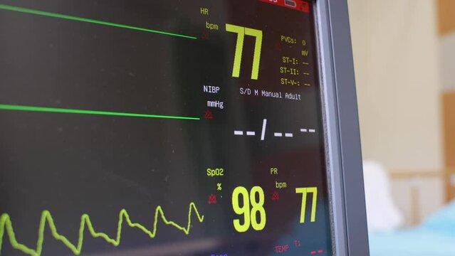 Electrocardiogram, EKG, heart rate monitor in hospital room for checking heart rate hospitalized patients