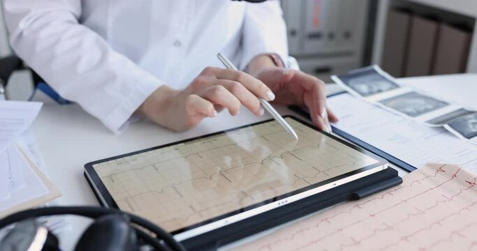A cardiologist examines a cardiogram on a tablet screen