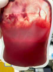 Red blood bag on white background.