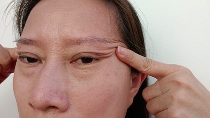 Obraz premium A woman's face has wrinkles.