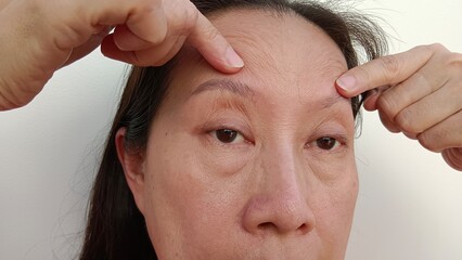 Obraz premium A woman's face has wrinkles.