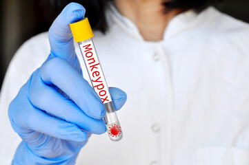 The concept of protection against monkeypox virus.  A medical worker wearing surgical face mask and gloves holding test tube, diagnosis and monkey pox research. 