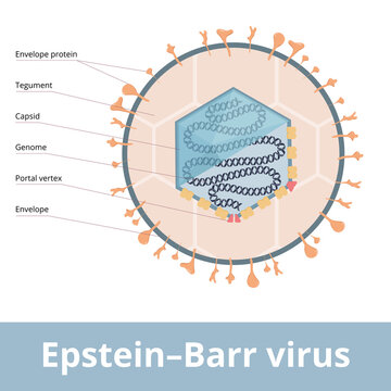Epstein&ndash;Barr virus (EBV, Human gammaherpesvirus 4) known as the cause of infectious mononucleosis. It is associated with  Epstein&ndash;Barr virus-associated lymphoproliferative diseases.