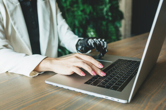 A close-up photo of a disabled woman with a bionic prosthesis is typing on a laptop while sitting at a table. Online work, distance learning. The concept of the future, cyborg