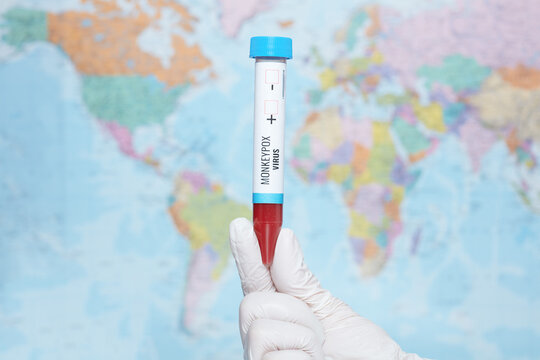 monkeypox test tube in front of map