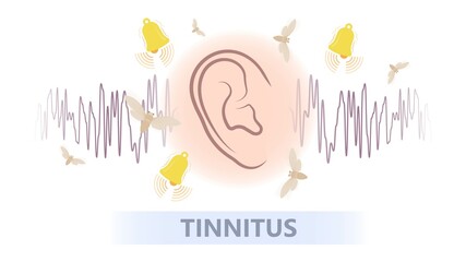 Tinnitus disorder a ringing sound in the ear hearing loss wave level anxiety test assist exam inner exposure problem circulatory nerves hair cell canal Earwax