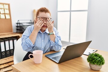 Young redhead woman working at the office using computer laptop rubbing eyes for fatigue and...
