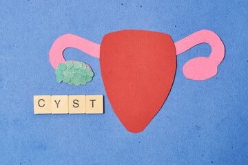 Female uterus made of paper with cyst. Concept Ovarian cyst.