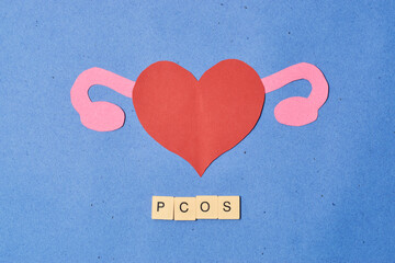 Concept polycystic ovary syndrome, PCOS. Women reproductive system