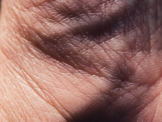 close up of skin
