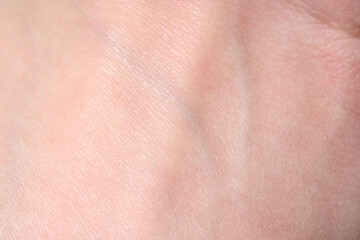 background of a pink skin texture. Healthy skin. Macro photo of skin cells.