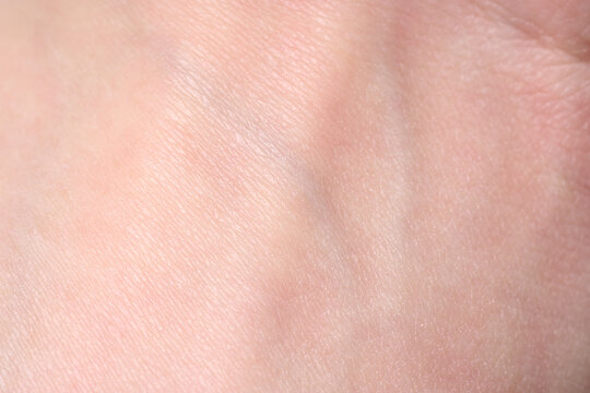 background of a pink skin texture. Healthy skin. Macro photo of skin cells.