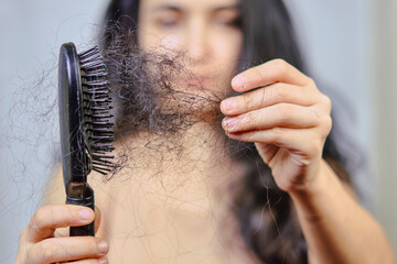 Female hairloss. Sad young woman with hair loss problem. Hair Loss problems. Woman with serious...