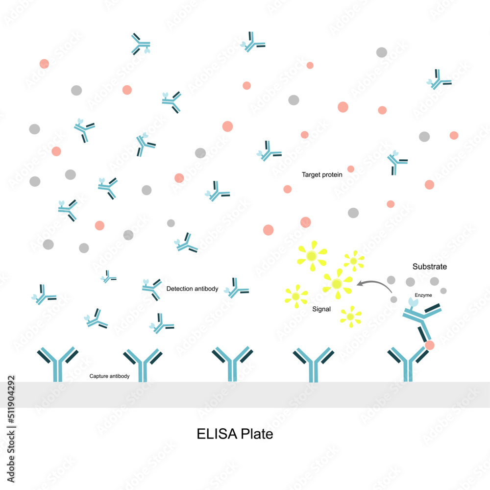 Poster The general principle of Sandwich ELISA for detecting the target protein or molecule