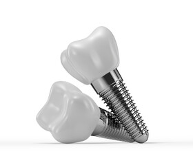 dental implants isolated on a white background. 3d rendering